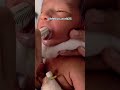 New born baby in NICU #hospital #hospital #internationallyeducatednurse #medical #nurse #medico