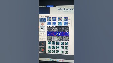 How AI is Transforming Heart Care | Dr. Khurram Nasir at Texas Heart Institute