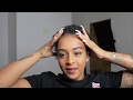 Hair Vlog #4 | 17 Weeks Since My Hair Transplant
