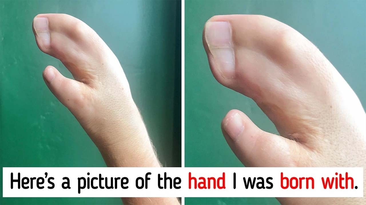 People Whose Body Full of Wonderful Treasures