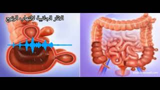 داء التهاب الرتوج