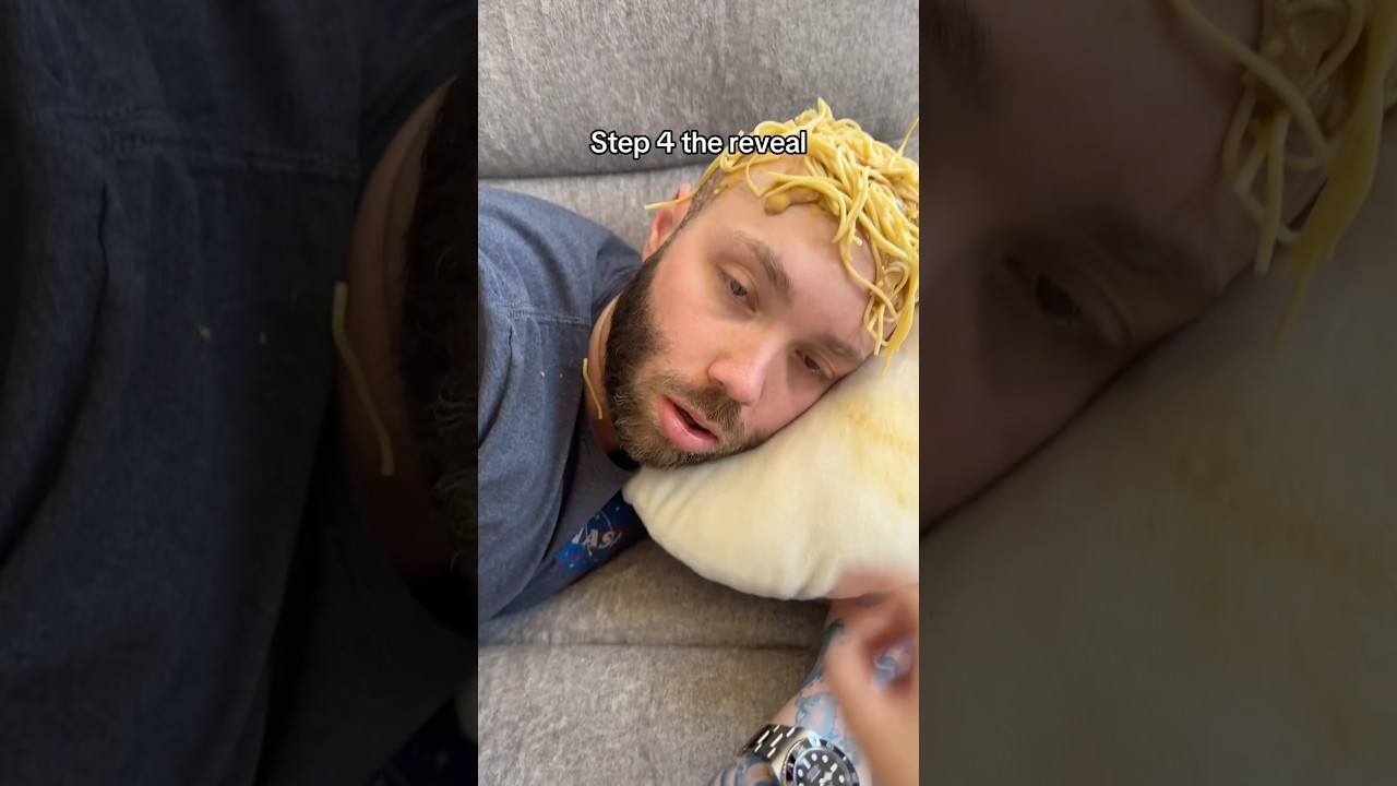 Spaghetti hair transplant