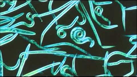 Part I: C Elegans Worm Unlocks a Mystery