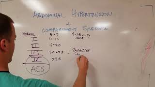 Abdominal Compartment Syndrome (and Abdominal Hypertension)