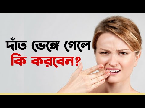 হঠাৎ দাঁত ভেঙে গেলে কি করবেন? || ভাঙ্গা দাঁতের চিকিৎসা || Broken teeth treatment