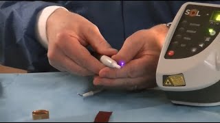 SOL® Desktop Laser - Get To Know Your Laser - DenMat Dental Education