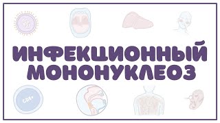 Инфекционный мононуклеоз (клиника, диагностика, лечение) лекция