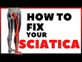 HOW TO FIX YOUR SCIATICA | IN TAGALOG | PHYSICAL THERAPY SESSION