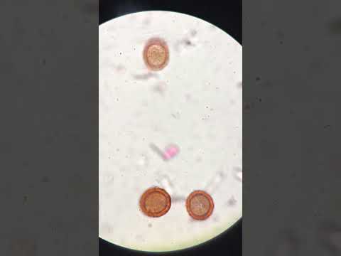 Vidéo: Quel microscope est utilisé pour voir les amibes ?