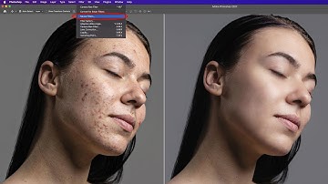 Is the Neural Filter the best option for retouching skin?
