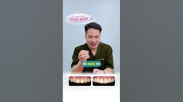 “Người phụ nữ đẹp nhất, là khi nụ cười của họ không còn phải giấu.” #drthu #bsthu #veneer #rangsu