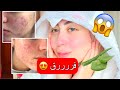 خمس مكونات طبيعيه غيرت بشرتي و صارت صافيه و تجنن شهد ناصر