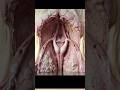 Bladder Trigone Explained: Macro Close-Up of the Clinical Urinary System Anatomy #education #shorts
