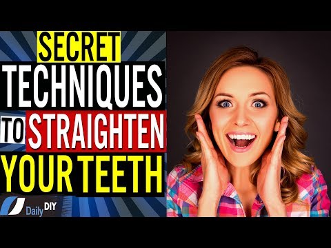 how-to-straighten-your-teeth-at-home-without-braces:-hidden-secret-techniques