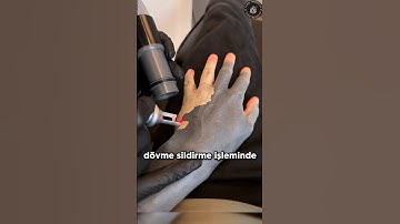 Silinen Dövmelerdeki Mürekkepler Nereye Gidiyor? ✒️ ✍🏻 😲