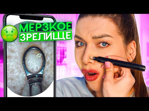 Видео: ЧИСТКА ПОД МИКРОСКОПОМ🧐РАСПАКОВКА ПОСЫЛОК! ТАКОГО Я ЕЩЕ НЕ ВИДЕЛА! ALIEXPRESS/WILDBERRIES