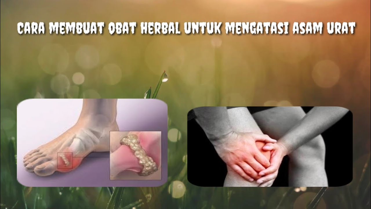 Obat herbal untuk mengatasi asam urat 