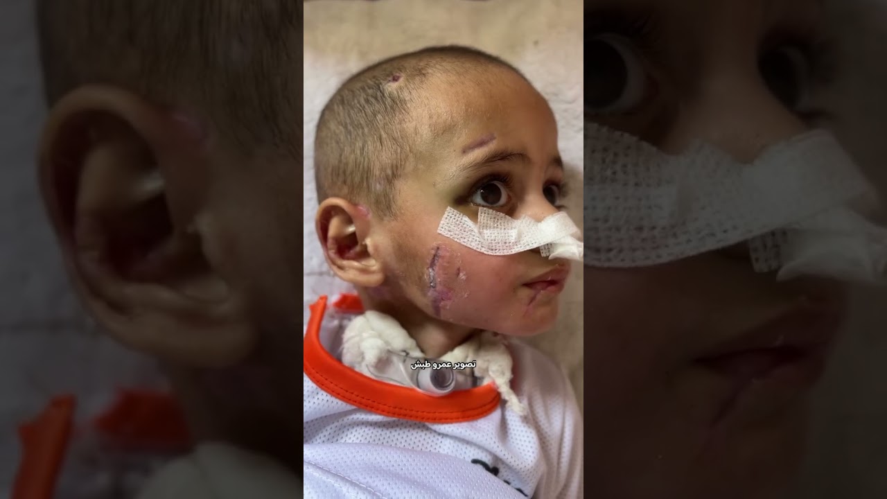 Thumbnail: Three-year-old Amro Al-Homs pulled from rubble in Gaza