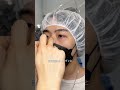 【二重整形/目頭切開】イケメン過ぎてジャニーズ入社#shorts