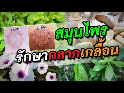 สมุนไพรรักษากลากเกลื้อน | ขี้กลากขี้เกลื้อนเนื้อหาที่เกี่ยวข้องที่ ... สมุนไพรรักษากลากเกลื้อน | ขี้กลากขี้เกลื้อนเนื้อหาที่เกี่ยวข้องที่ ...
