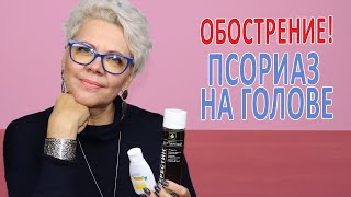 ОБОСТРЕНИЕ! ПСОРИАЗ на ГОЛОВЕ!