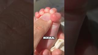 Babinski Reflexes in babies 😱 #facts #shorts