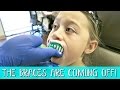 SHE'S GETTING HER BRACES OFF! | FAMILY VLOG