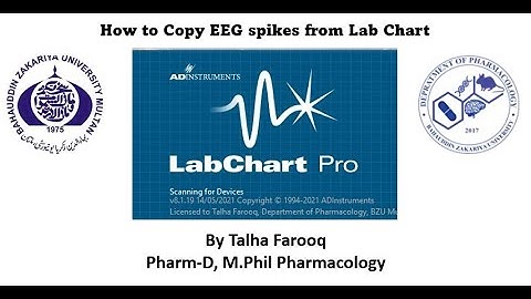 How to extract EEG spikes from Lab Chart