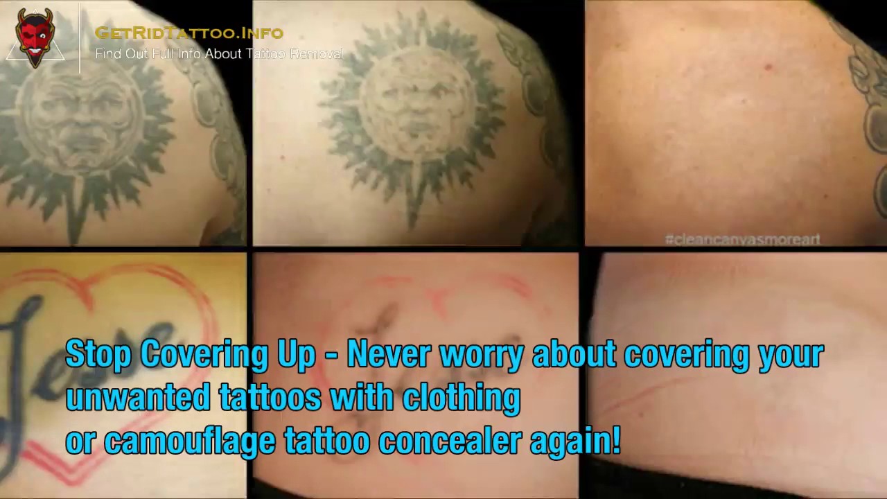 Tattoo Fading – All you must to learn about tattoo removing. Article ...