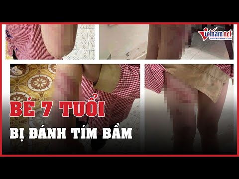 Video Hải Phòng: Bé trai 7 tuổi sống với mẹ và 