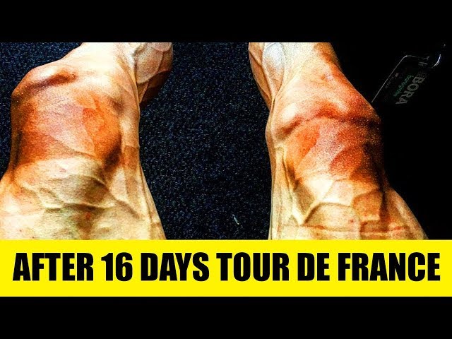 6 Unbelievable Photos That Show The Power Of The Mind!