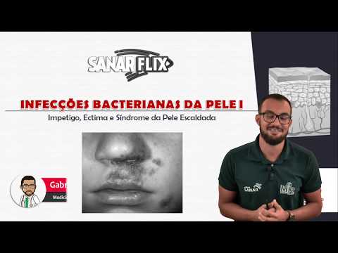 Vídeo: Infecção Fúngica Da Pele: Tipos, Tratamento, Prevenção