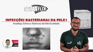 Por danos nos infecção em casa nervos