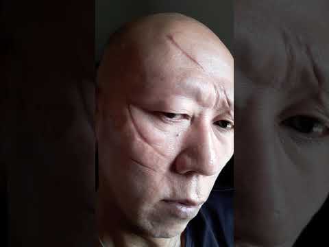 刀傷 刃物傷 顔 Youtube 刀傷 刃物傷 顔 Youtube
