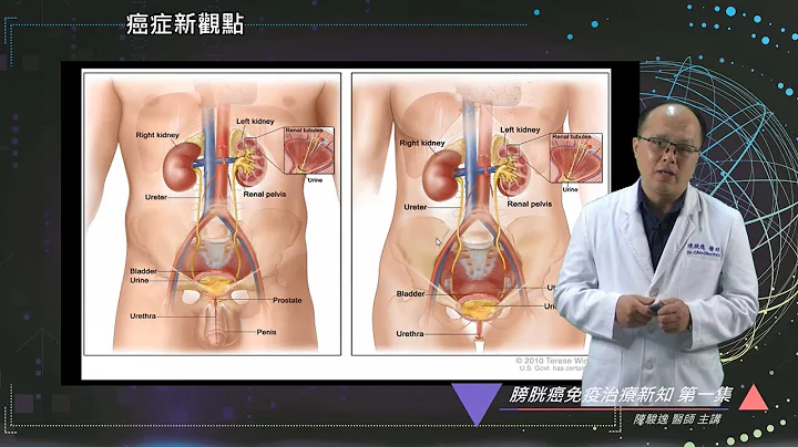 免疫觉醒online-膀胱癌免疫治疗新知 第一集 - 天天要闻