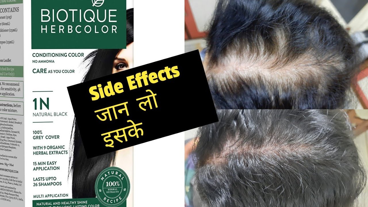 Details more than 74 biotique hair dye super hot in.eteachers