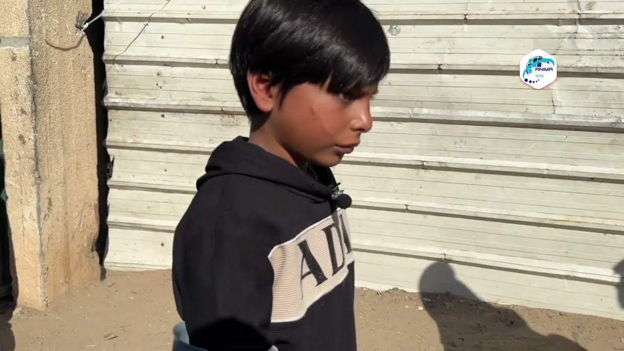 صاروخ دمر وجهه وساقه.. الطفل إسلام الفيراني يبكي غزة