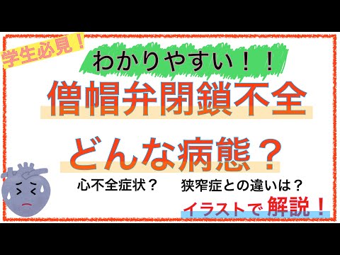 僧帽弁閉鎖不全症についてわかりやすく解説！〜心不全症状がみられる理由や心房細動になる理由とは〜