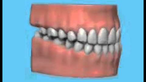 lost canine guidance