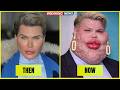 35 Celebrity Plastic Surgery Stories That Surprised Everyone | Then and Now Photos 2026