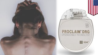 pain elimination small spinal implant helps chronic pain sufferers control aches tomonews