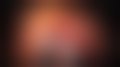 Robotic Single Site Pyeloplasty