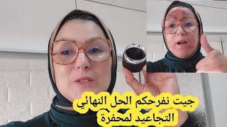 عندك شحمة دالكلوة مستحيل يبقاو فيك التجاعيد( المحفرة) على مسؤوليتي