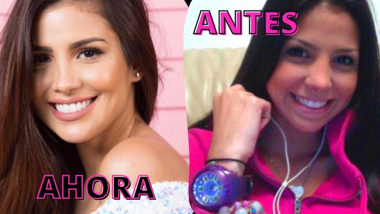 👀 Así lucia KARLIS ROMERO antes de Operarse 😱😱 / Mas Entretenimiento💗 -KARLIS ROMERO antes y después