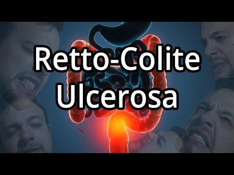 Video: Colite Ulcerosa: Sintomi E Trattamento Delle Feci