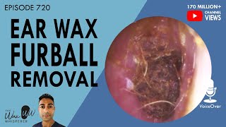 720 - Ear Wax Furball Removal 720 - Ear Wax Furball Removal