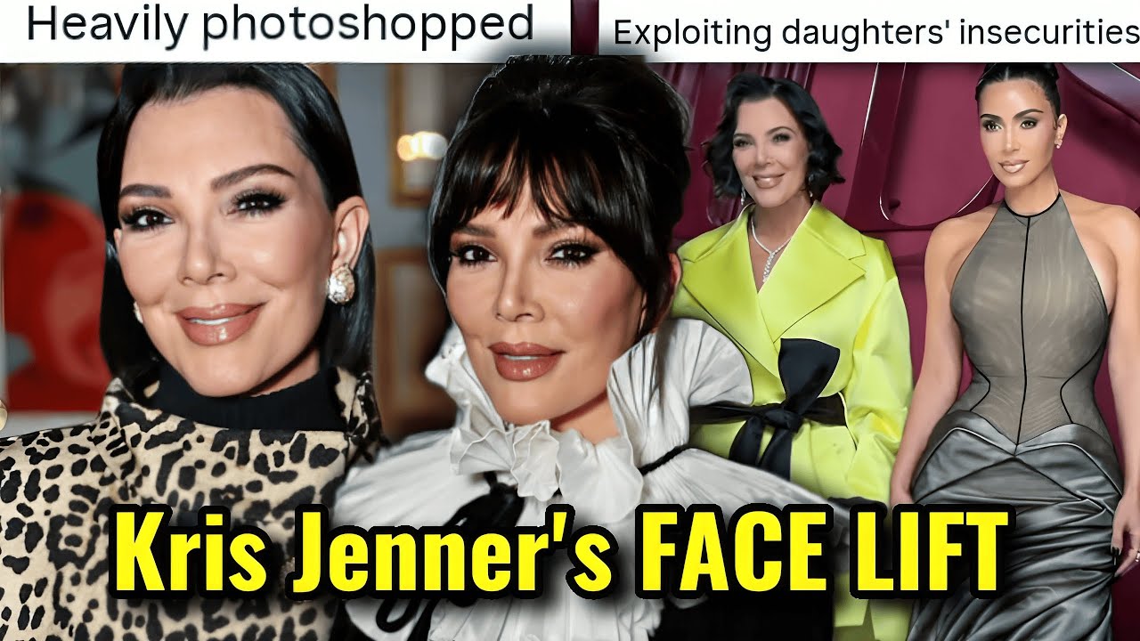 KRIS JENNER'S BAD FACE LIFT: GLORIFYING PLASTIC ENHANCEMENTS IN THE INDUSTRY