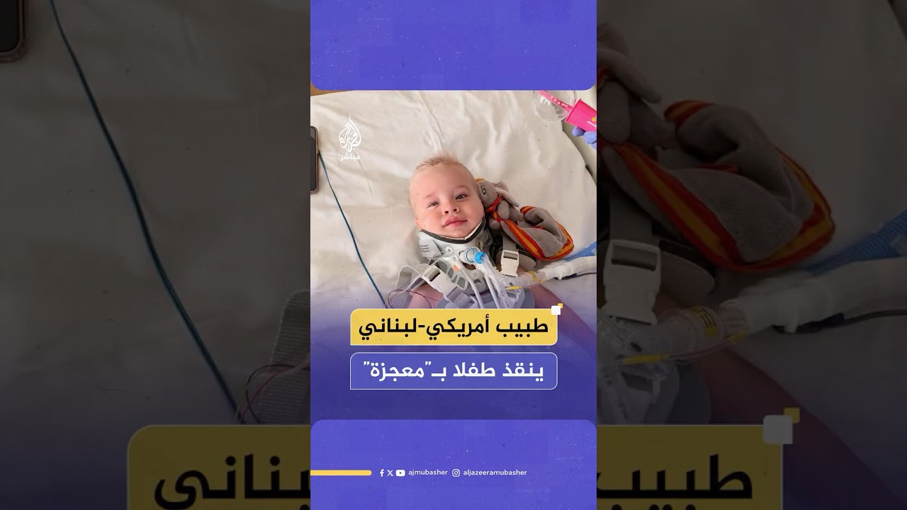 في جراحة “إعجازية”.. طبيب أمريكي من أصول لبنانية ينقذ طفلا من الموت ويعيد وصل رأسه بجسده