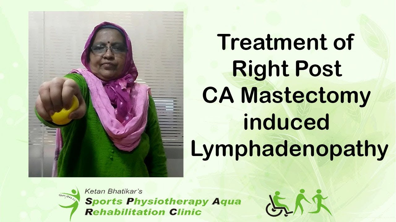 Treatment of Right Post CA Mastectomy induced Lymphadenopathy
