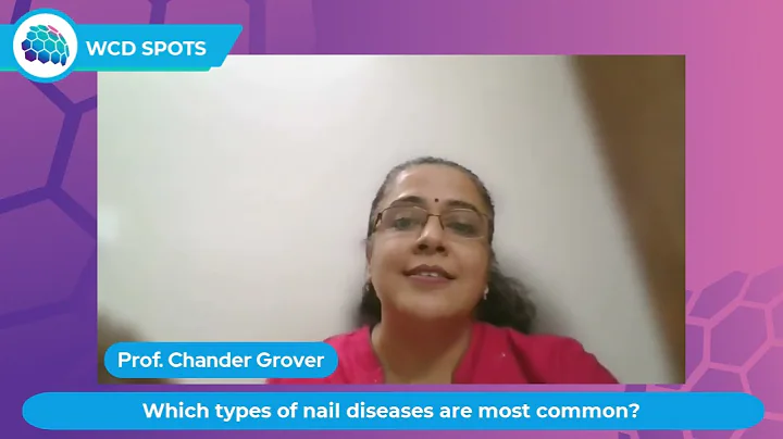 WCD Spots - Prof. Chander Grover